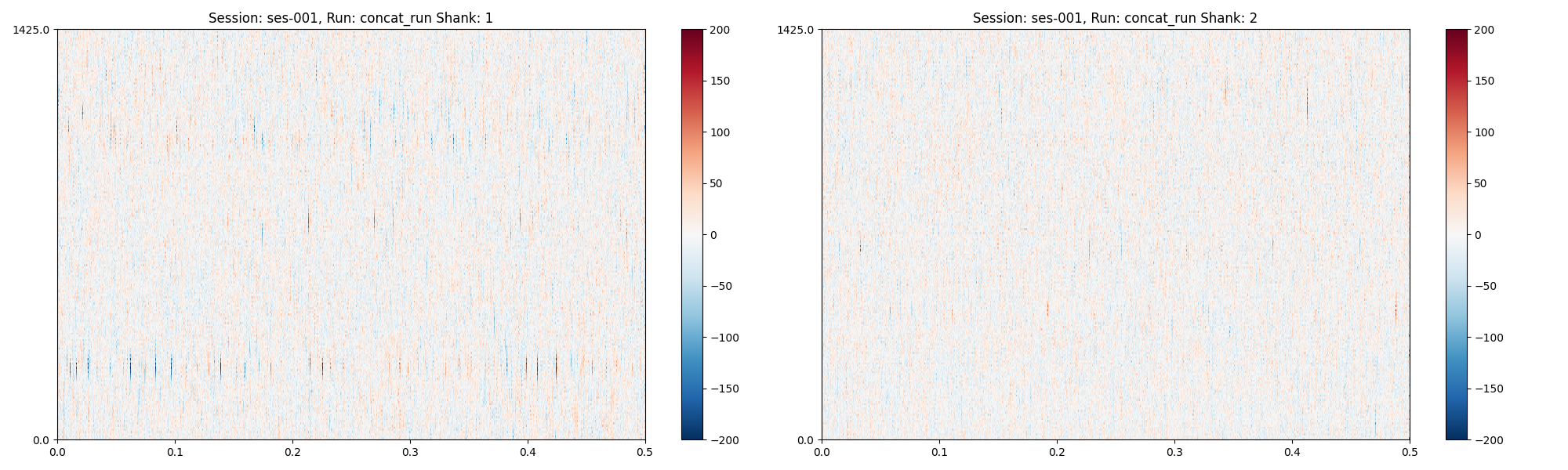 Session: ses-001, Run: concat_run Shank: 1, Session: ses-001, Run: concat_run Shank: 2
